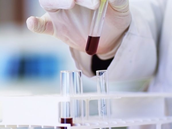 Uroalliance lab